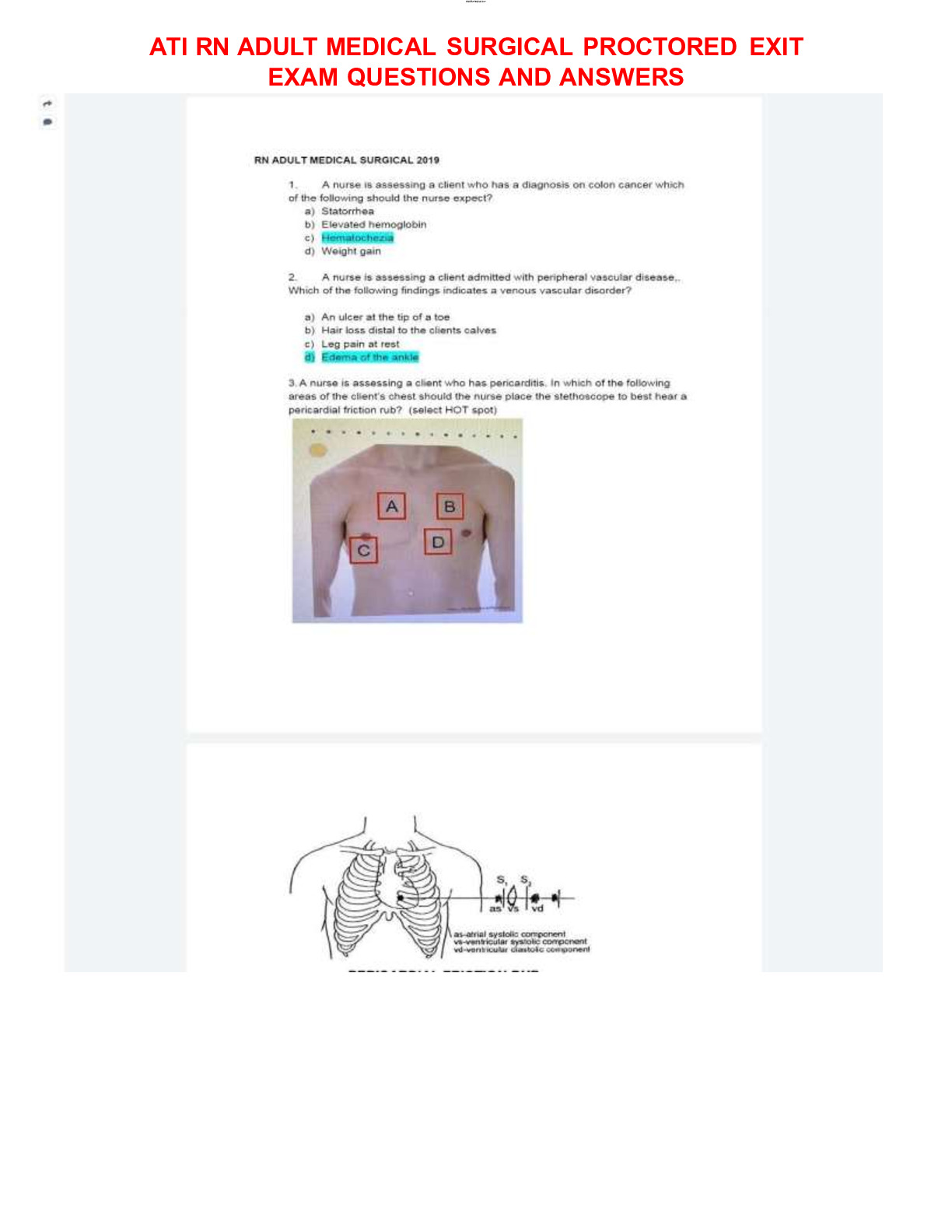 Ati medical surgical proctored exam 2023 with ngn questions and correct