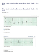 Relias Dysrhythmia Basic Test Answers Solution guide Package 2024-2025