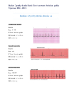 Relias Dysrhythmia Basic Test Answers Solution guide Updated 2024-2025