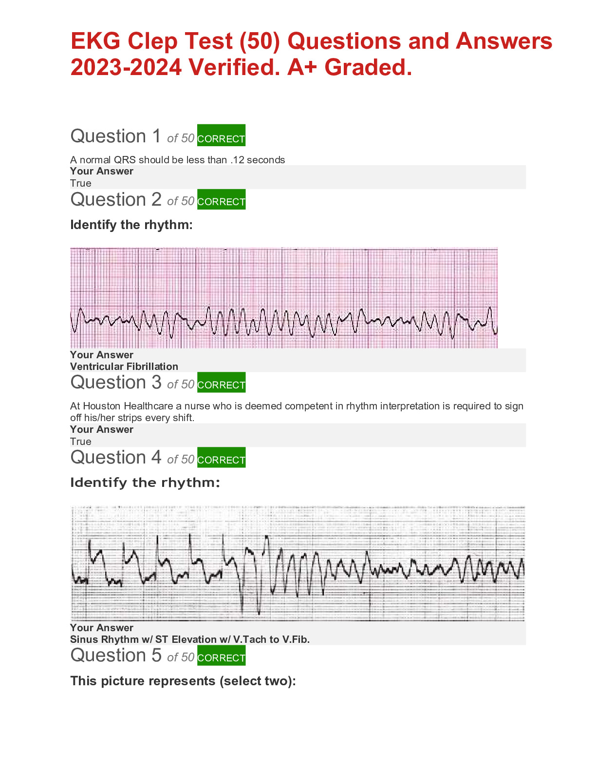 EKG Clep Test (UPDATED 2025) - DocMerit