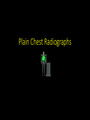 chest X rays full easy explanation guide
